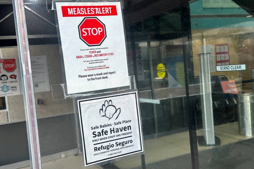 South Carolina’s measles milestone is everyone’s problem