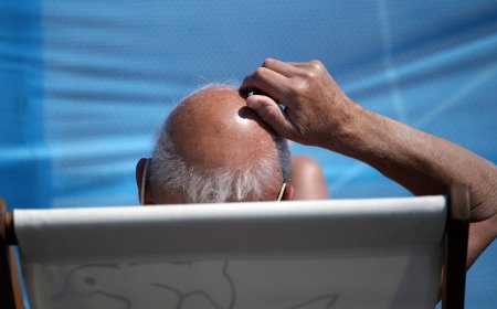 Forget GLP-1 stocks, baldness drugs are Wall Street’s next goldmine